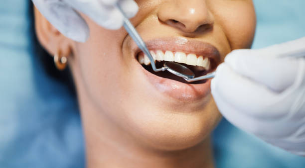 Best Broken or Cracked Tooth Emergency Dentist in Golden, CO